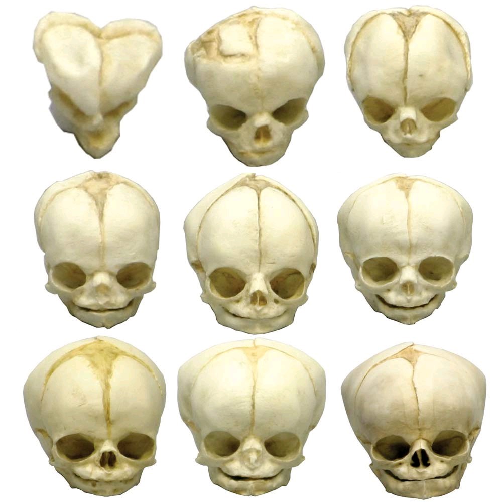 Fetusschädel Anatomie Modell, Schädelmodell, Fetus, Versch. Entwicklungs-Wochen