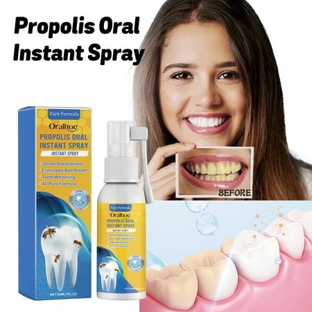 ANTBABA Propolis Oral Care Spray Cleans Stains and Tartar  Removes Odors  Freshens Breath  Whitens and Beautifies Teeth