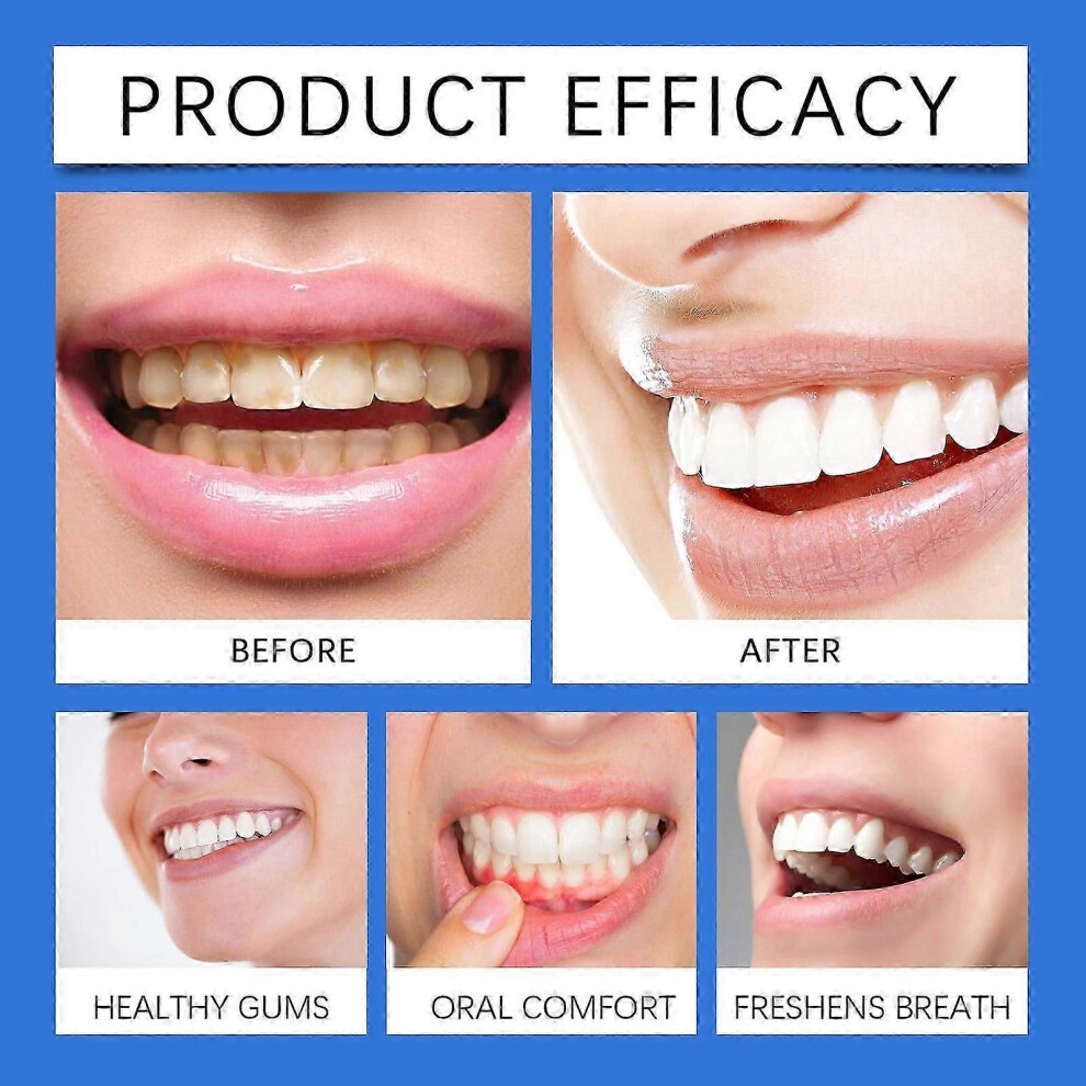 (2Pcs) Propolis Oral Instant Treatment Spray, Propolis Oral Health Spray,Clean Teeth Stains and Tartar Spray Fresh Breath Propolis Oral Spray thumbnail