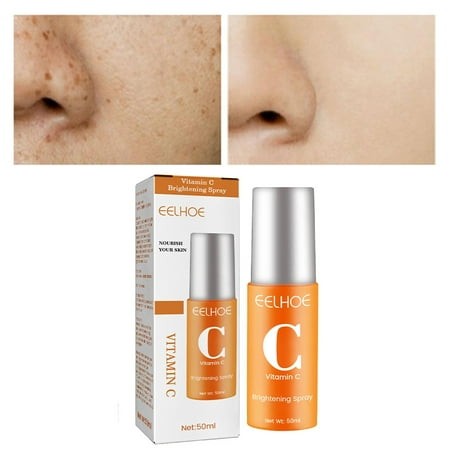 VC Mist Serum with Hyaluronic Acid & Propolis Extract - 50ml Hydrating Facial Spray for Glowing Skin  Moisturizing Toner Substitute  Evenly Sprays Nut