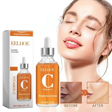 Ziynglg VC Serum Mist for Face Hydrating and Nourishing Spray for Men and Women Propolis and Hyaluronic Infused Substitute Toner for Glowing