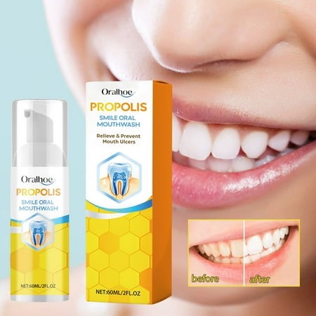 Momihoom Propolis Oral Health Spray  Propolis Teeth Cleaning Spray  Propolis Oral Spray  Fresh Breath