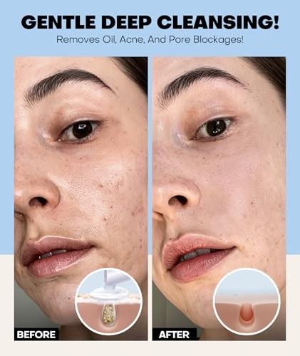 Gentle Foaming Face Wash, Deep Cleansing Facial Cleanser with Brush Moisturizing & Non-Irritating Face Cleanser for Sensitive Dry All Skin, PH Balanci thumbnail