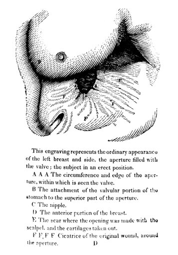 William Beaumont N(1785-1853) American Surgeon Page from the First Edition of William BeaumontS Experiments and Observations on the Gastric Juice 1833