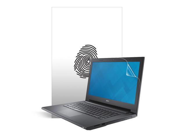 Celicious Matte Plus Dell Inspiron 14 3443 Anti-Glare Shatterproof Screen Protector