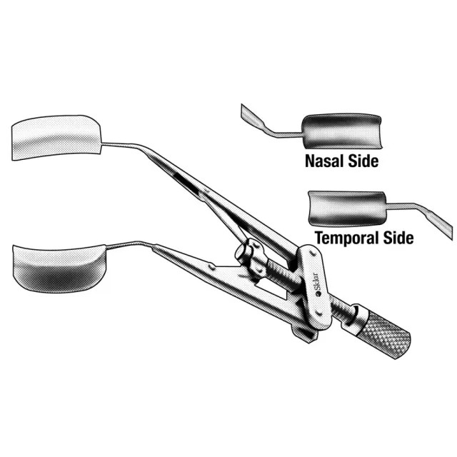 Sklar 65-7681 Speculum