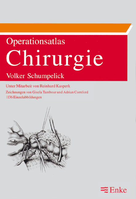 Operationsatlas Chirurgie, Mit 1136 Einzelabbildungen