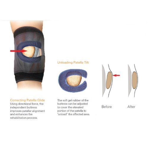 Kuhl Shields Knee Brace. Size: S, Mid-Patella Circum. 12