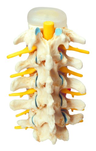 3B Scientific 12-4542 Anatomical Model Vertebrae Degeneration Stages of Prolapse thumbnail
