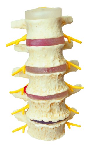 3B Scientific 12-4542 Anatomical Model Vertebrae Degeneration Stages of Prolapse thumbnail