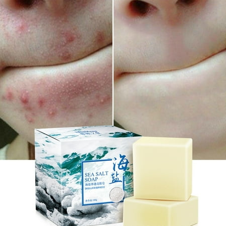 Natural Bar Soap Quickly Remove Mites Repair Nourish Skin Gentle Cleansing Bar for Dry/Sensitive Skin Moisturizing Body Wash Soap Bar Rich in Sea Sea 