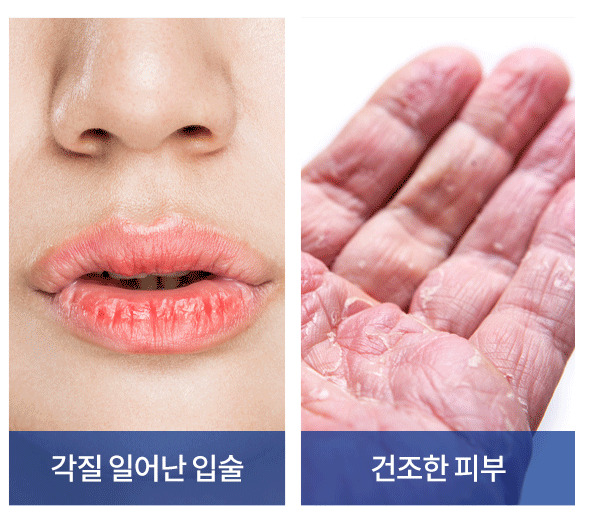 Daeil Pharmaceutical Germany White Vaseline 100 Ml Petrolium 100% Moisturizing S thumbnail